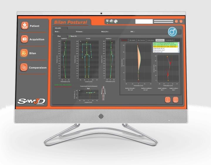 SAM3D LITE/LITE+ posture analysis software