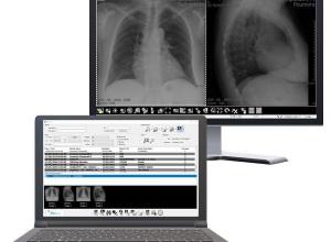 Med Diag - Diagnostic Workstation for Radiology