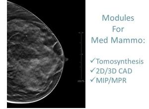 Tomosynthesis - MIP/MPR - CAD Modules