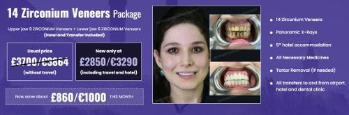 Full mouth dental implants Turkey