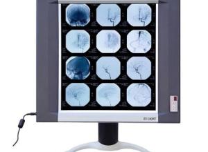 LED Ultra Slim LED X-ray Film Viewer
