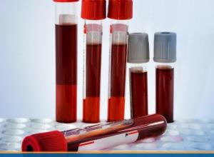 Blood Tests